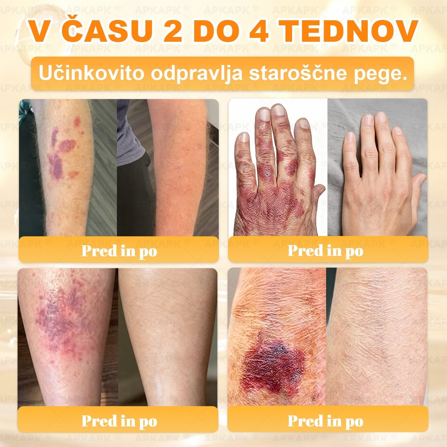 🎁 Na voljo je samo še 5 paketov! Zdaj prejmete dodatnih 50% popusta! Ostanite zdravi. Če te priložnosti ne izkoristite zdaj, bo naslednja šele prihodnje leto!