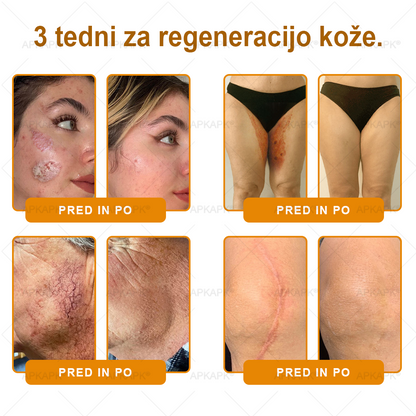 🎁 Na voljo je samo še 5 paketov! Zdaj prejmete dodatnih 50% popusta! Ostanite zdravi. Če te priložnosti ne izkoristite zdaj, bo naslednja šele prihodnje leto!