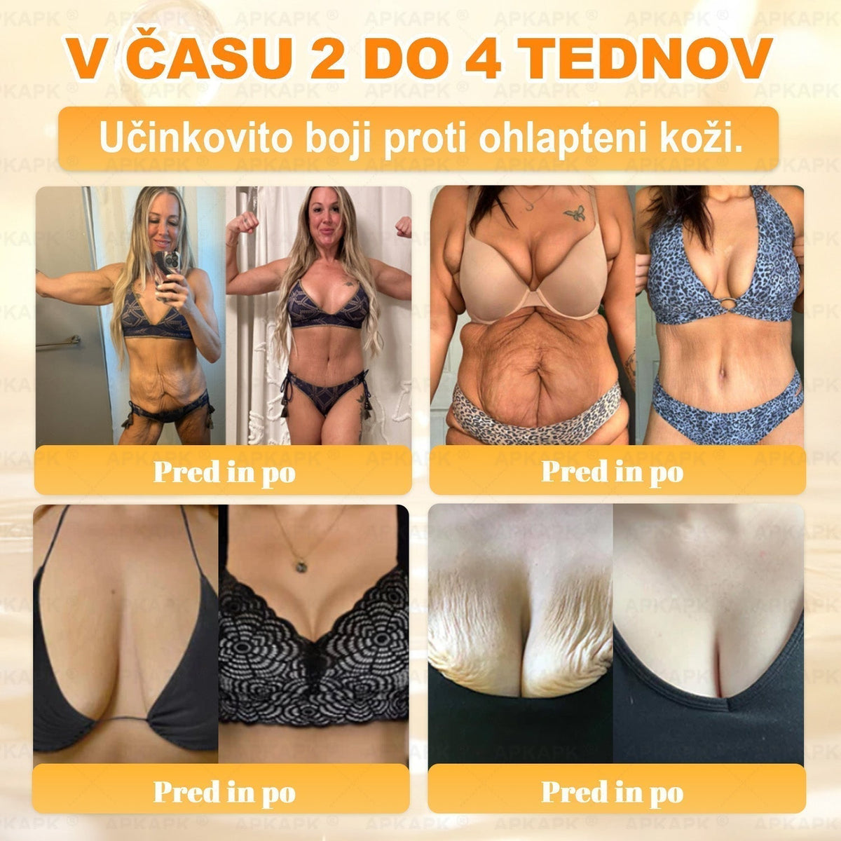 🐝 Časovno omejena ponudba | APKAPK® krema s čebeljim strupom za obnovo kože in zmanjšanje videza gub 🍃 Ciljno delovanje proti gubam in za nego kože z različnimi nepravilnostmi.
