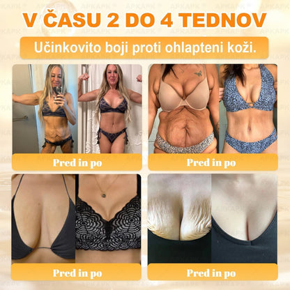 🐝 Časovno omejena ponudba | APKAPK® krema s čebeljim strupom za obnovo kože in zmanjšanje videza gub 🍃 Ciljno delovanje proti gubam in za nego kože z različnimi nepravilnostmi.