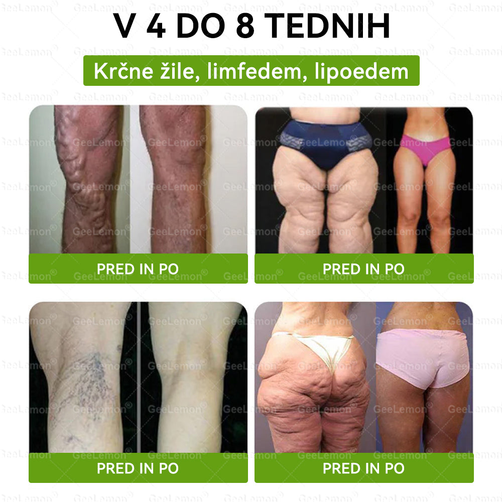 🎁 Na voljo je samo še 5 paketov! Zdaj prejmete dodatnih 50% popusta! Ostanite fit in zdravi. Če te priložnosti ne izkoristite zdaj, bo naslednja šele prihodnje leto!