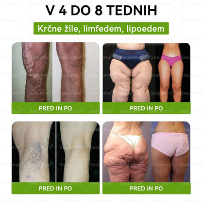🎁 Na voljo je samo še 5 paketov! Zdaj prejmete dodatnih 50% popusta! Ostanite fit in zdravi. Če te priložnosti ne izkoristite zdaj, bo naslednja šele prihodnje leto!