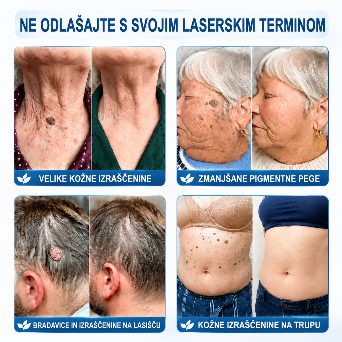 🎁 Na voljo je samo še 5 paketov! Zdaj prejmete dodatnih 50 % popusta! Poskrbite za bolj gladek, negovan in samozavesten videz kože. Če te priložnosti ne izkoristite zdaj, bo naslednja šele prihodnje leto!