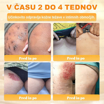 🐝 Časovno omejena ponudba | APKAPK® krema s čebeljim strupom za obnovo kože in zmanjšanje videza gub 🍃 Ciljno delovanje proti gubam in za nego kože z različnimi nepravilnostmi.