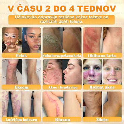 🐝 Časovno omejena ponudba | APKAPK® krema s čebeljim strupom za obnovo kože in zmanjšanje videza gub 🍃 Ciljno delovanje proti gubam in za nego kože z različnimi nepravilnostmi.