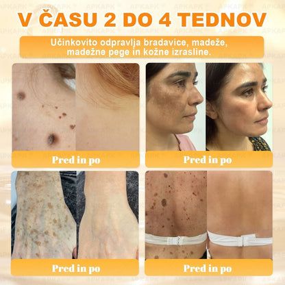 🐝 Časovno omejena ponudba | APKAPK® krema s čebeljim strupom za obnovo kože in zmanjšanje videza gub 🍃 Ciljno delovanje proti gubam in za nego kože z različnimi nepravilnostmi.