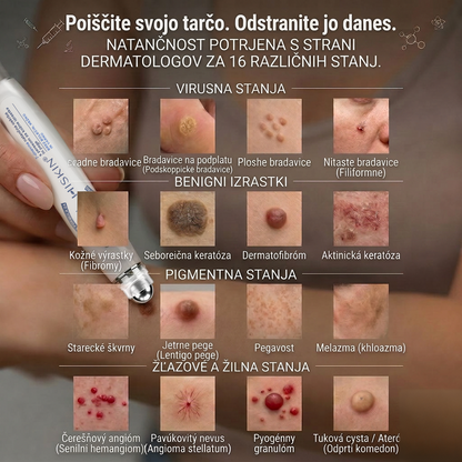 🎁 Na voljo je samo še 5 paketov! Zdaj prejmete dodatnih 50 % popusta! Poskrbite za bolj gladek, negovan in samozavesten videz kože. Če te priložnosti ne izkoristite zdaj, bo naslednja šele prihodnje leto!