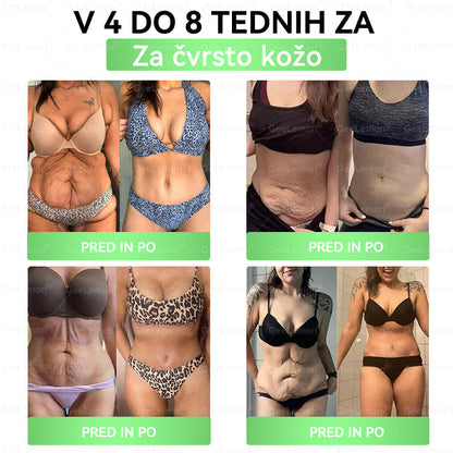 🎁 Na voljo je samo še 5 paketov! Zdaj prejmete dodatnih 50% popusta! Ostanite fit in zdravi. Če te priložnosti ne izkoristite zdaj, bo naslednja šele prihodnje leto!