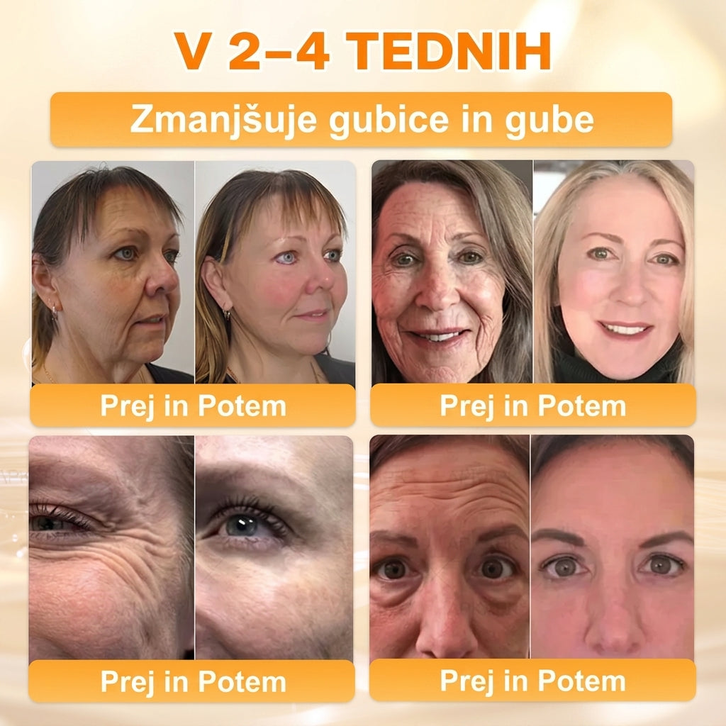 🐝 Časovno omejena ponudba | APKAPK® krema s čebeljim strupom za obnovo kože in zmanjšanje videza gub 🍃 Ciljno delovanje proti gubam in za nego kože z različnimi nepravilnostmi.