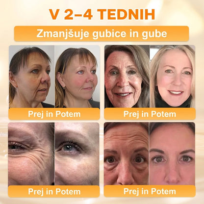 🐝 Časovno omejena ponudba | APKAPK® krema s čebeljim strupom za obnovo kože in zmanjšanje videza gub 🍃 Ciljno delovanje proti gubam in za nego kože z različnimi nepravilnostmi.
