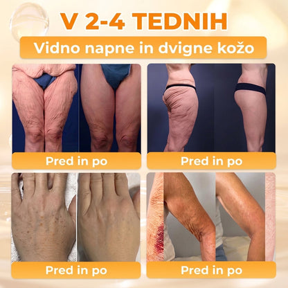 🐝 Časovno omejena ponudba | APKAPK® krema s čebeljim strupom za obnovo kože in zmanjšanje videza gub 🍃 Ciljno delovanje proti gubam in za nego kože z različnimi nepravilnostmi.